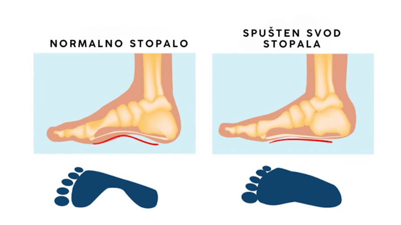 razlika medju stopaliima